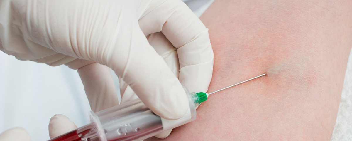 Blood Based Epigenetic Screen Tests For Diabetes Complications