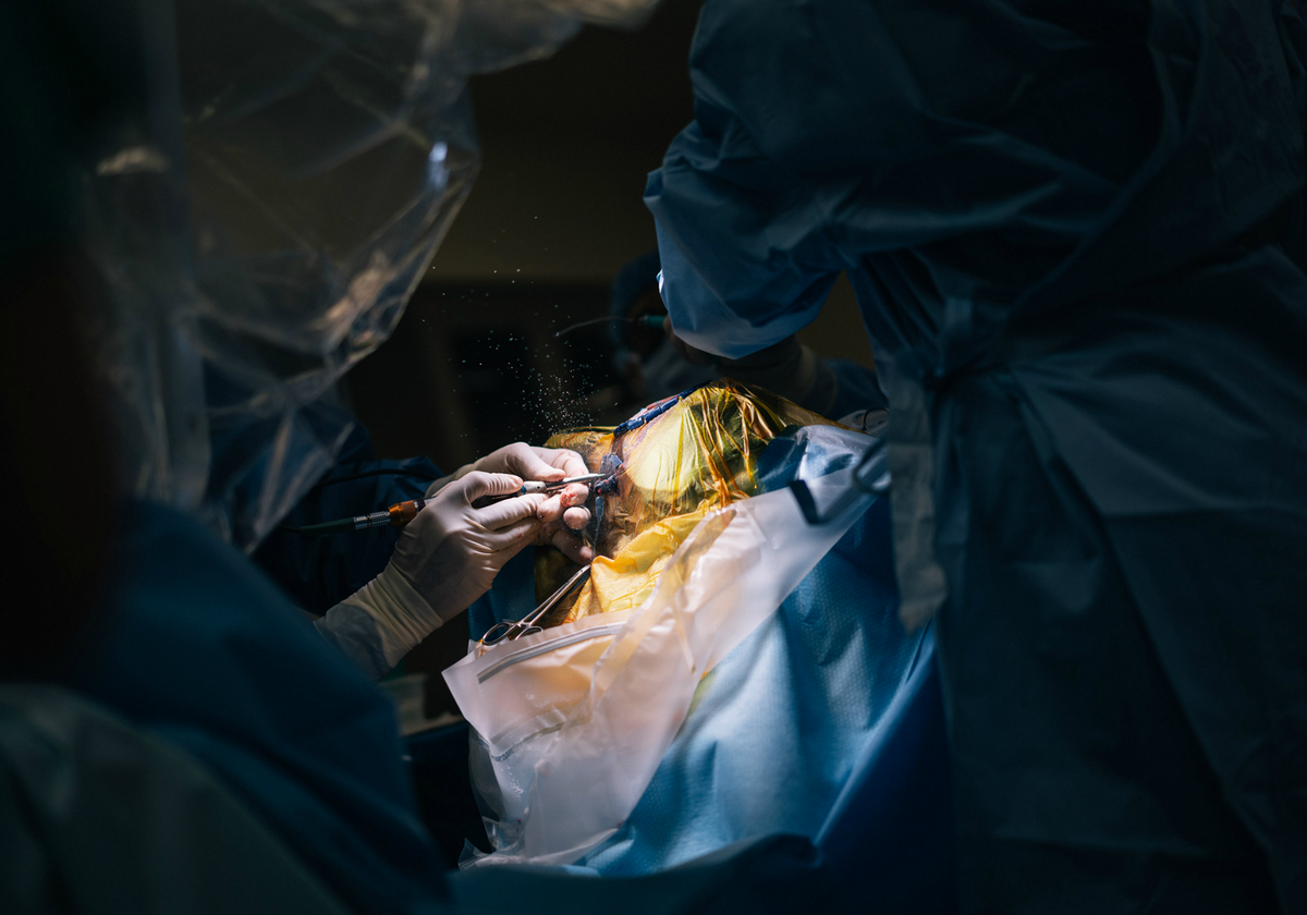 Can Preventing Seizures Alter The Course Of Autism The