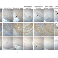 antibody validation reproducibility crisis C9ORF72