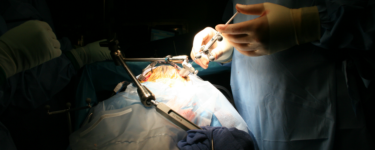 Neural Stem Cell Transplantation Crawls Toward The Clinic The