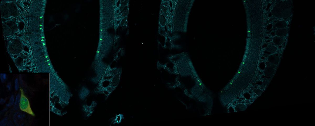 Chemosensory Cells In The Nose Play A Role In Allergic Reactions