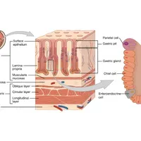 Gastric Cancer | The Scientist