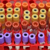 Test Lab Survay Laboratory Testing | The Scientist