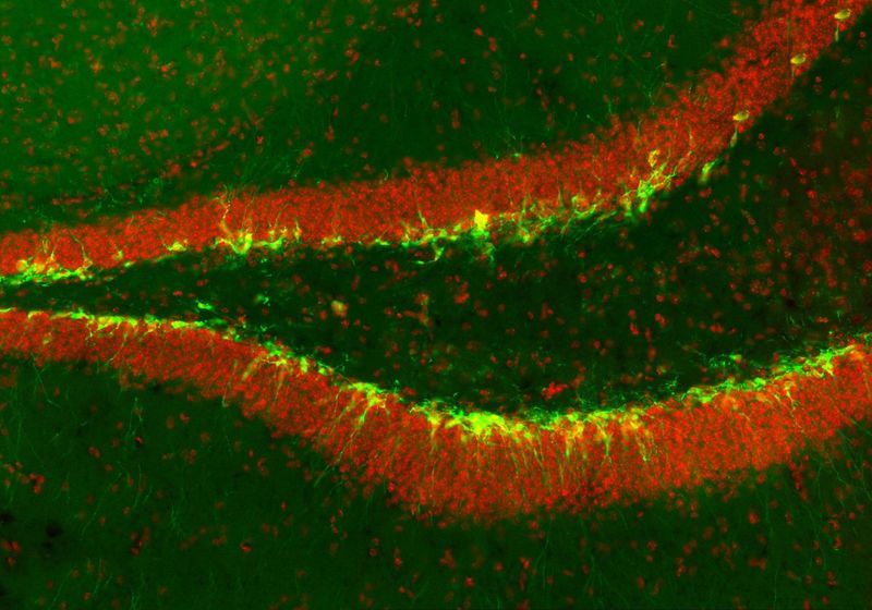 Adult-Born Neurons Strengthen Memories While Mice Sleep | The Scientist