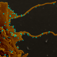 Coronavirus-Infected Cells Grow Filopodia