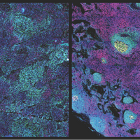 germinal centers antibody antibodies covid-19 sars-cov-2 pandemic coronavirus immunity