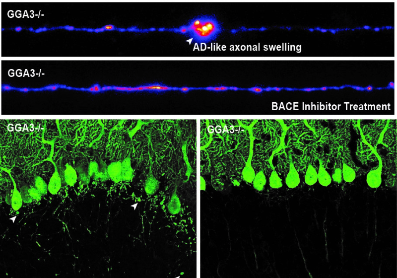 Alzheimer's-Linked Mutation Causes Blockages in Neurons