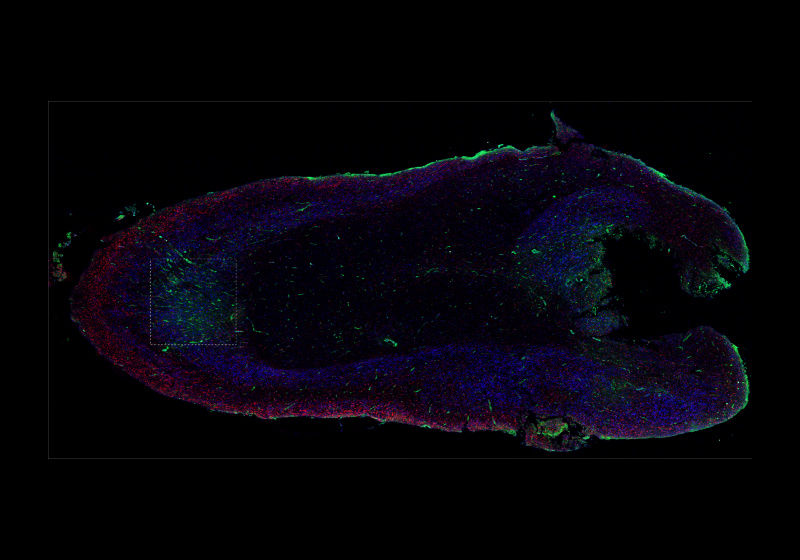 COVID-19&rsquo;s Effects on the Brain