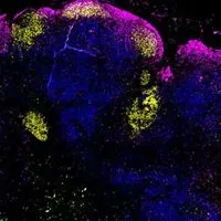 Pfizer Vaccine Induces Immune Structures Key to Lasting Immunity 