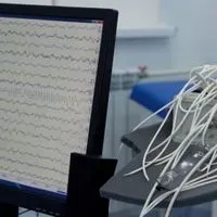 Seizures Common in Hospitalized COVID-19 Patients