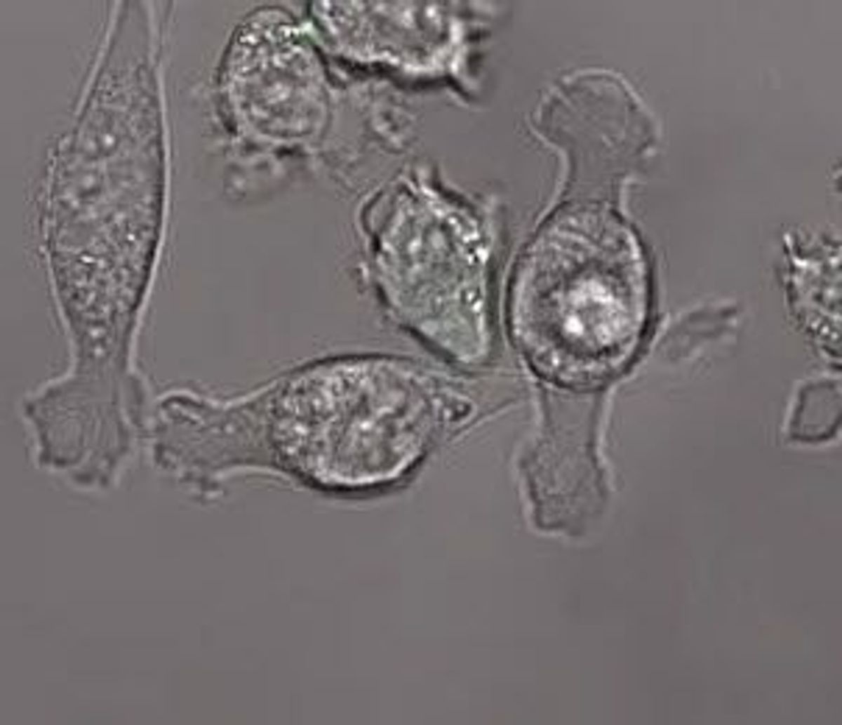 Engineered Immune Cells Eliminate Brain Cancer in Mice - Vimarsana News
