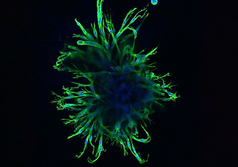 Organoid Shape Identifies Potential Cancer Drugs 