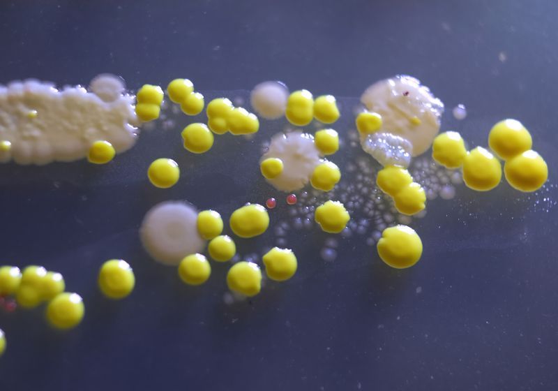 Gut Fungi Hamper Radiation Therapy in Mice with Cancer