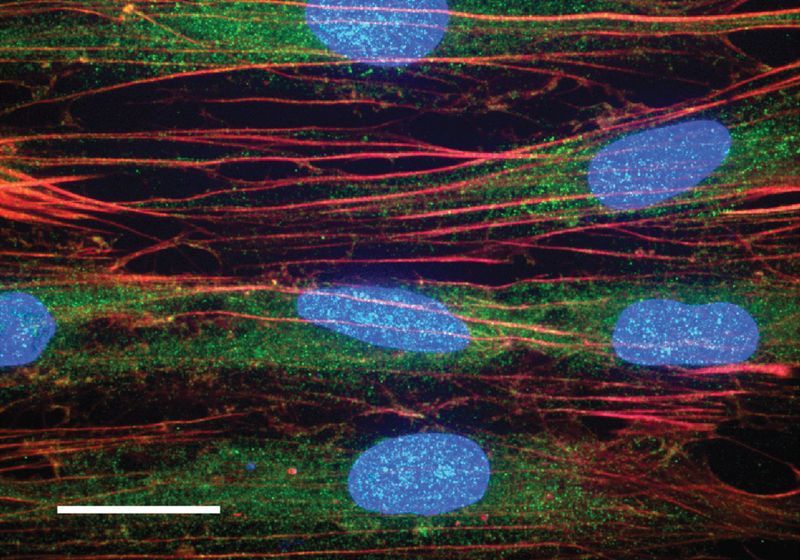 Mechanosensory Protein Helps Tendons Stiffen After Exercise