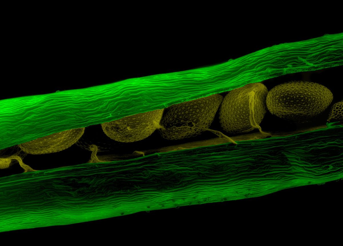 Essential Genes Protected from Mutations - Vimarsana News
