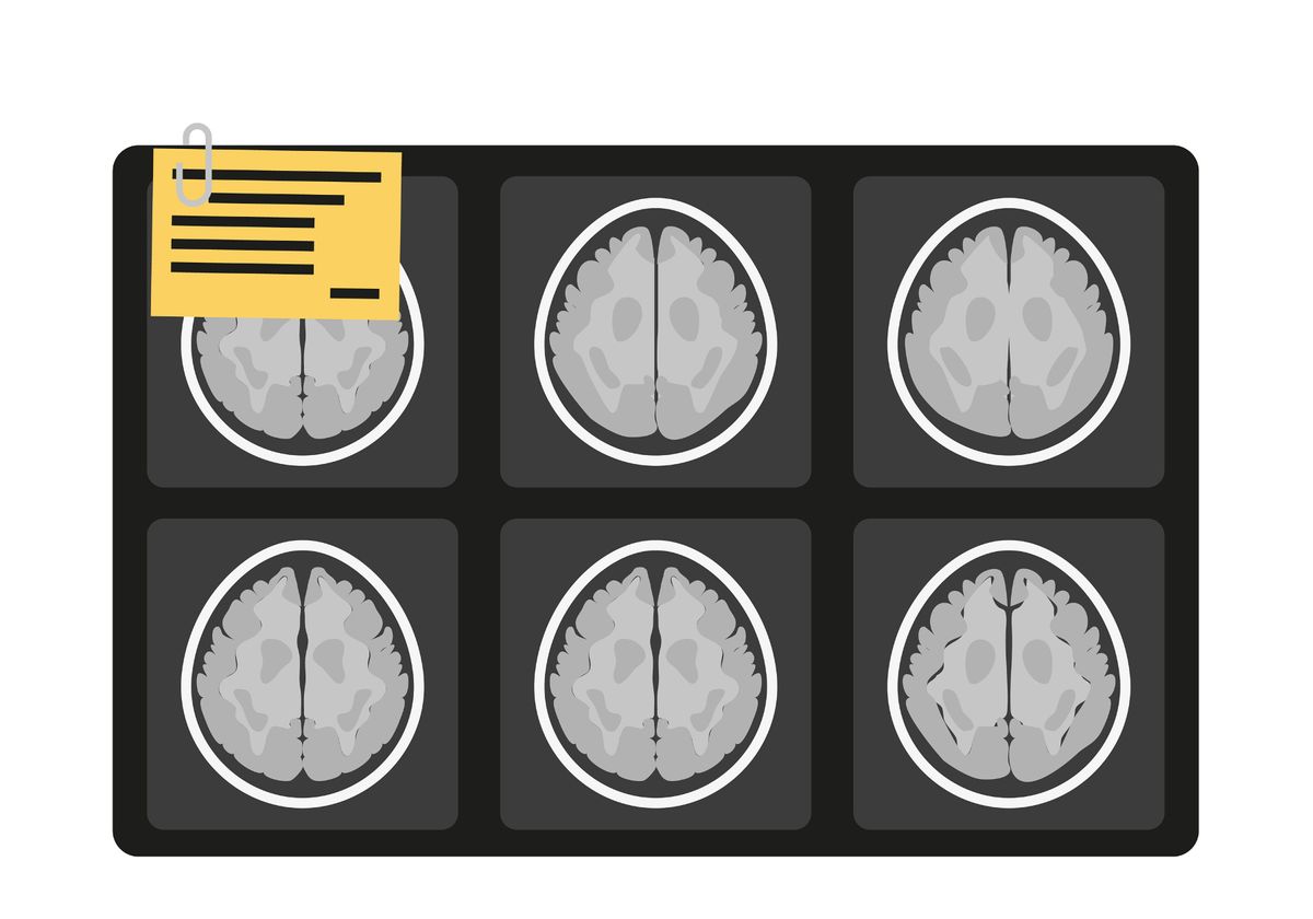 Power Shortages Dim Results of Many Neuroimaging Studies - Vimarsana News