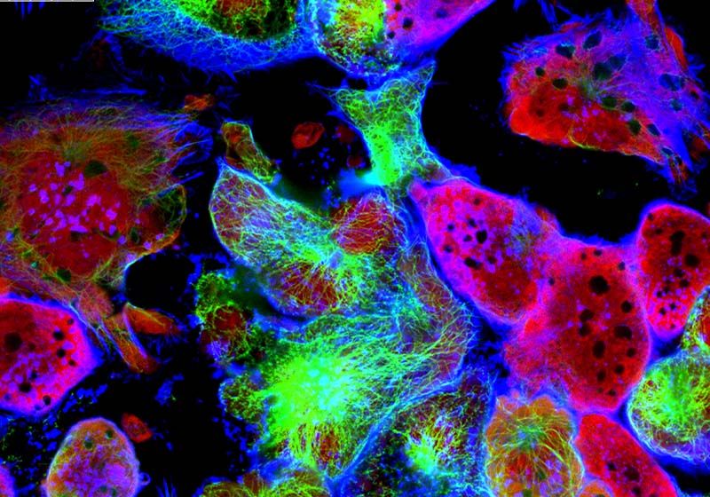 Seeing is Believing with Automated Single Cell Precision Imaging | The ...