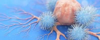 Analyzing Multiple Dimensions of Cancer Biology | The Scientist
