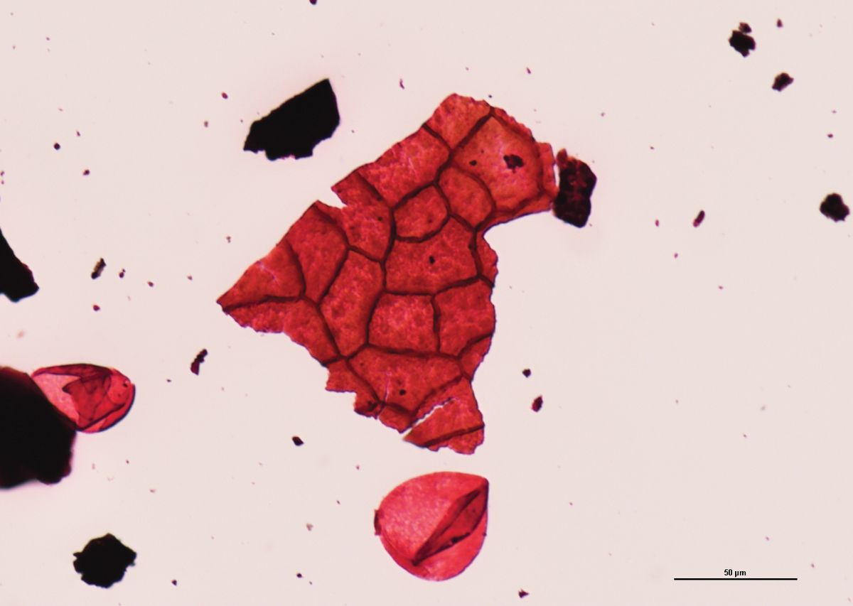 Micrograph of a fragment of leaf cuticle showing epidermal cells (clustered) and a fern spore (bottom right) from a K-Pg site in southern Colorado