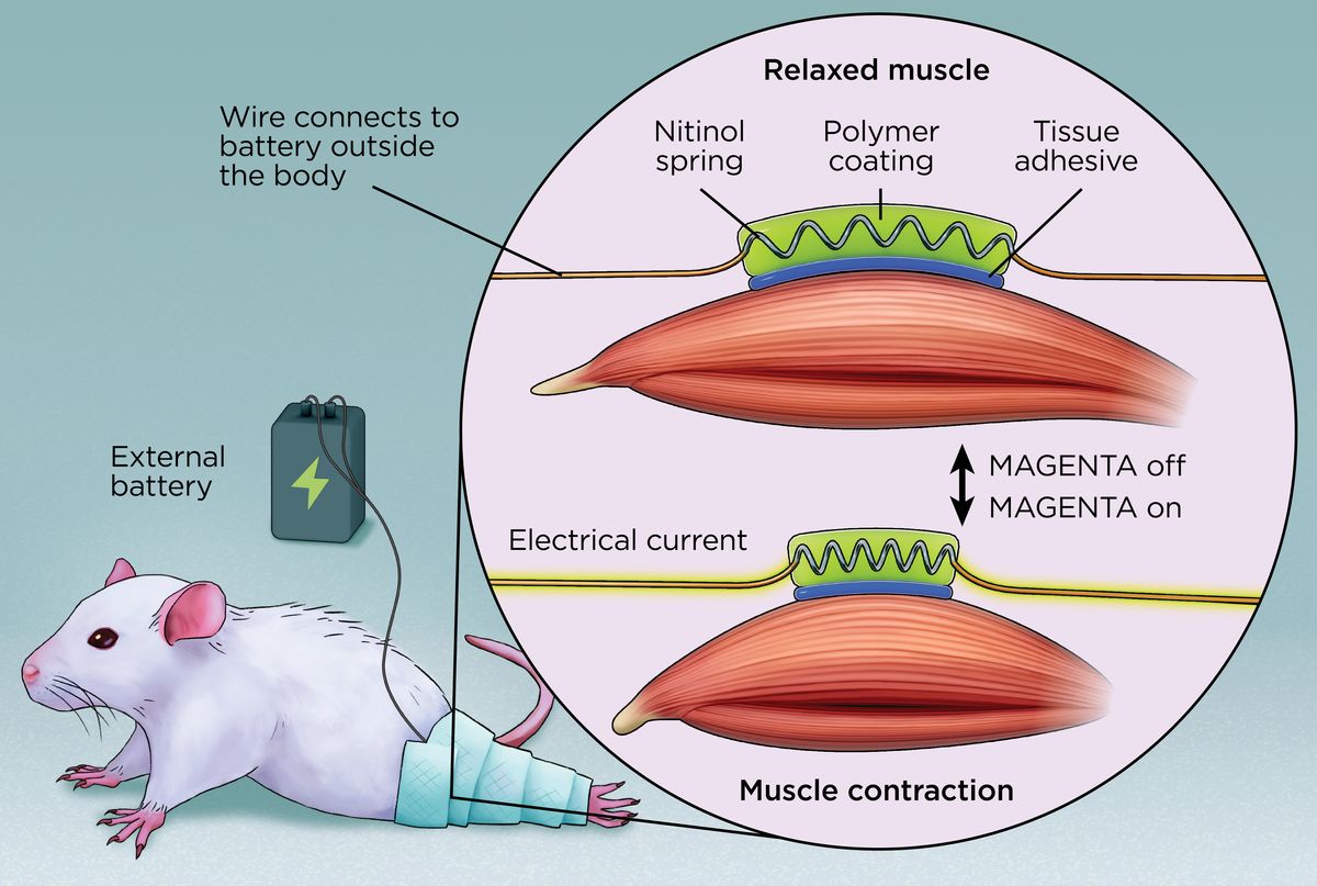 Muscular Stimulation – The World of Implantable Devices