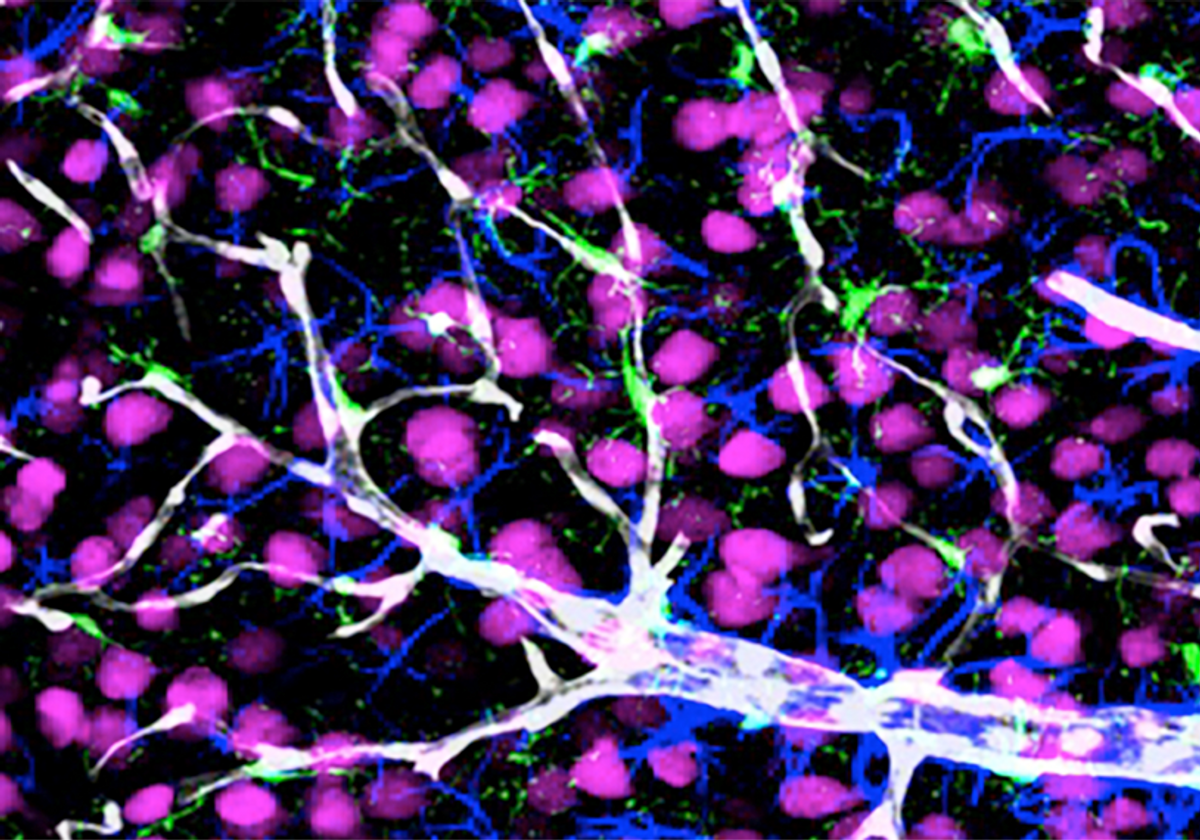 Rare Autism-Linked Mutation Starves Growing Neurons of Essential Nutrients - Vimarsana News