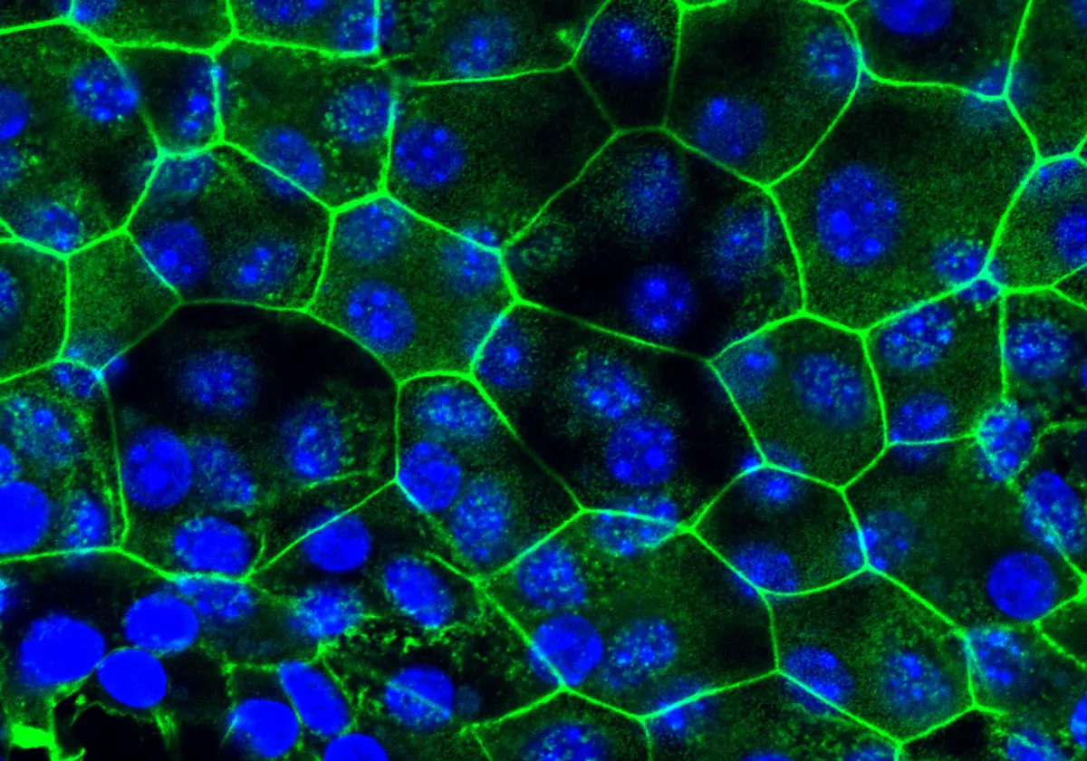 Bladder epithelial tissue, where cell junctions are shown in green and nuclei in blue. This was grown in vitro from cells taken from mice with chronic cystitis. Bladder epithelial tissue, where cell junctions are shown in green and nuclei in blue. This was grown in vitro from cells taken from mice with chronic cystitis.