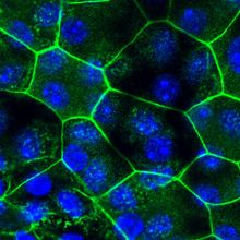 Bladder epithelial tissue, where cell junctions are shown in green and nuclei in blue. This was grown in vitro from cells taken from mice with chronic cystitis.