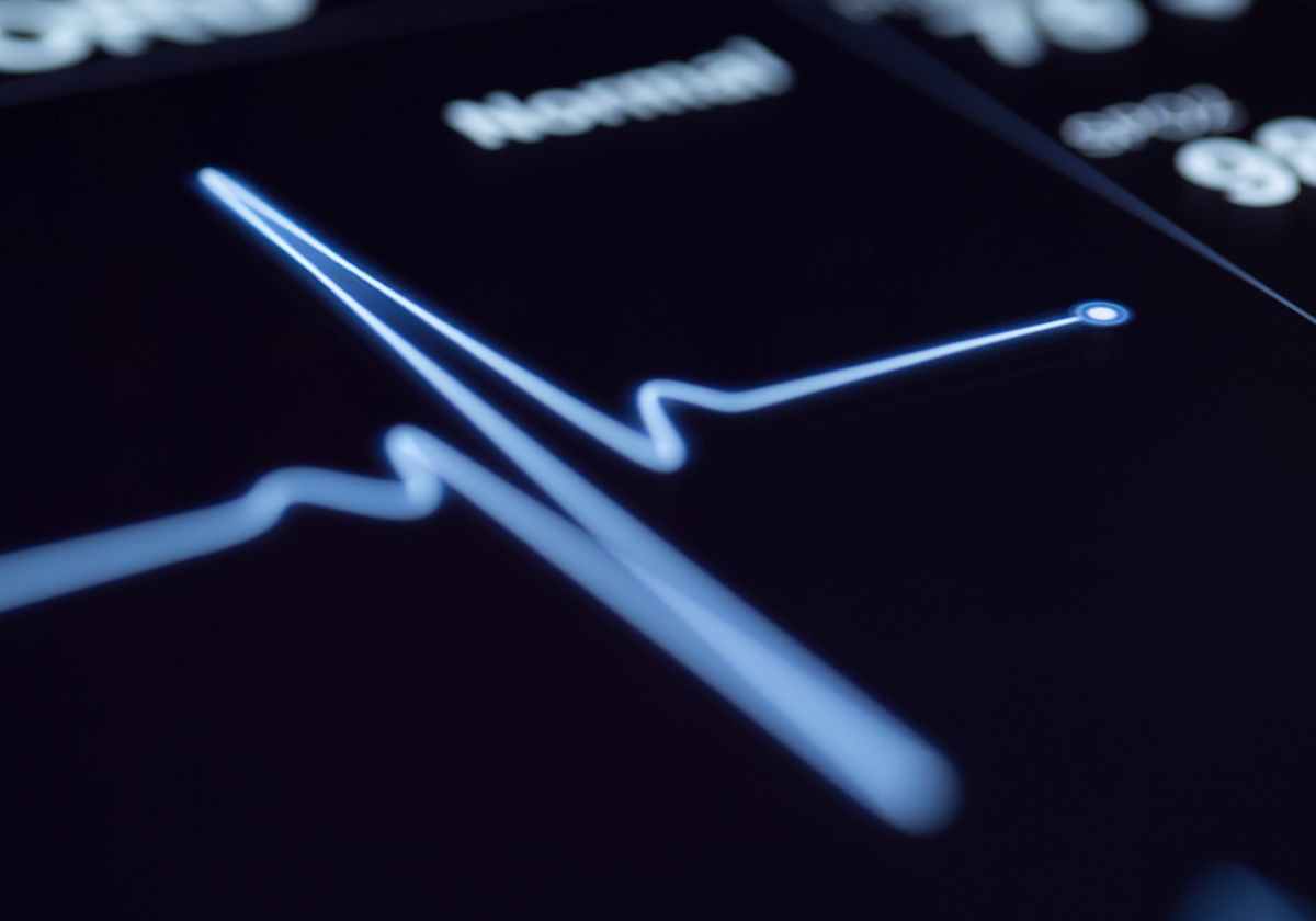 The Circadian Rhythm of the Heart Rate - Vimarsana News