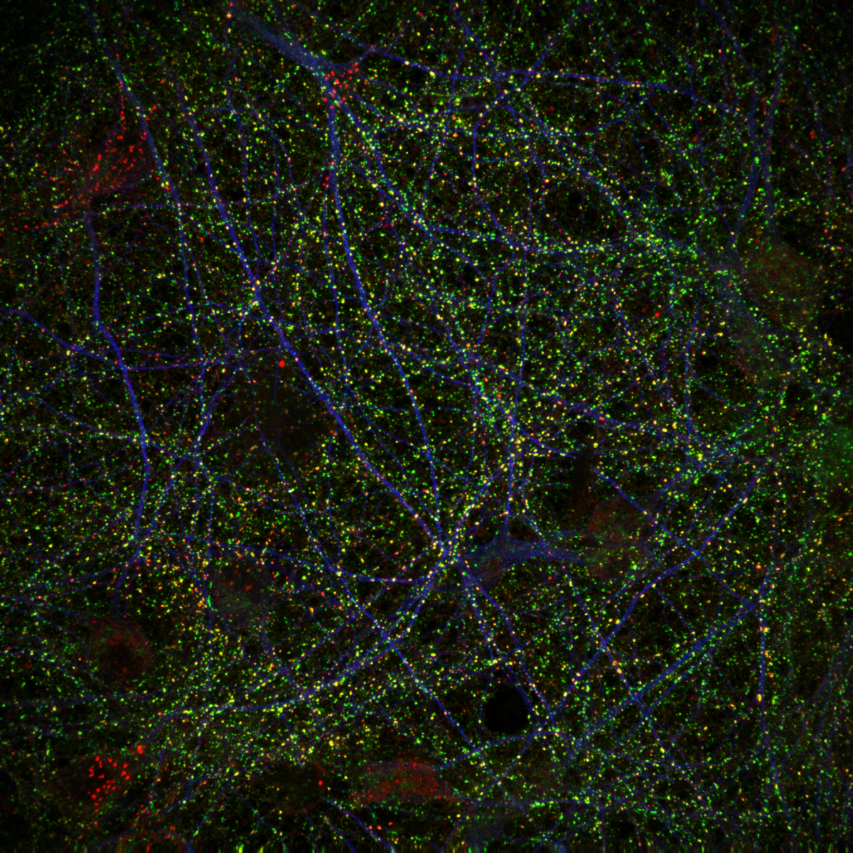 A microscopy image of immunostained neurons after <em >myo</em>-inositol supplementation.” title=”A microscopy image of immunostained neurons after <em >myo</em>-inositol supplementation.” loading=”lazy”/></source></source></source></source></source></source></picture></div><figcaption class=