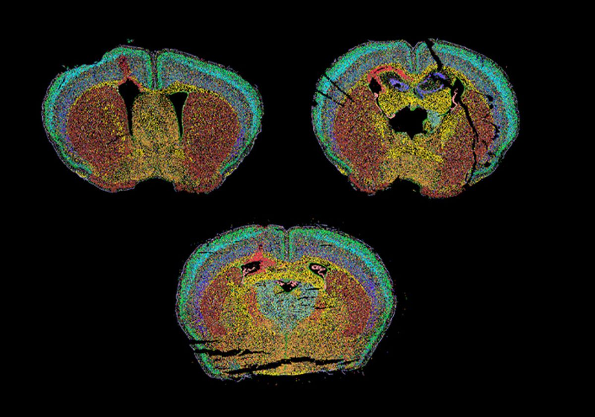 Charting a New Course Through the Injured Brain | The Scientist