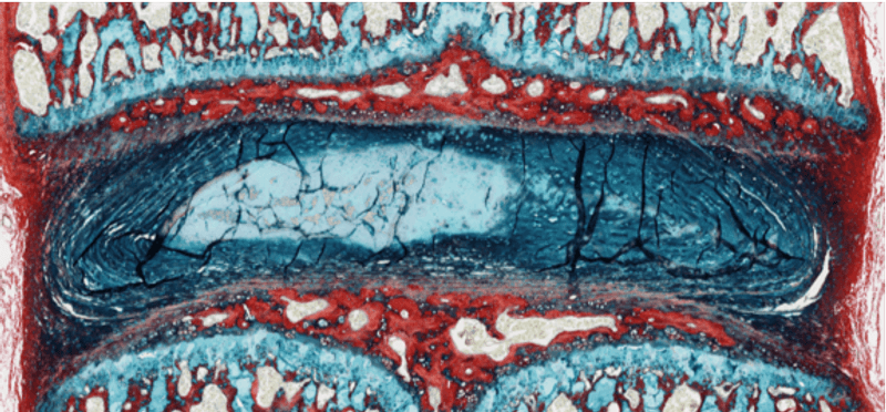 Back Pain Explained | The Scientist