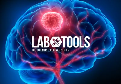 Viewing the Glioblastoma Tumor Microenvironment at Single Cell Resolution Viewing the Glioblastoma Tumor Microenvironment at Single Cell Resolution