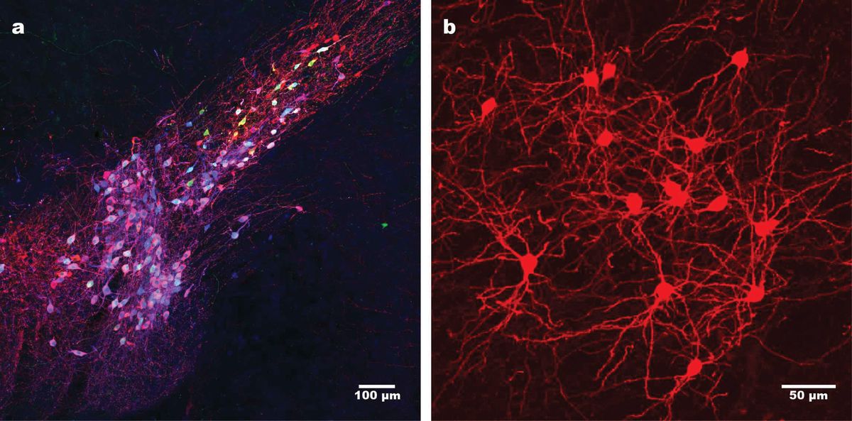 On the left, purple neurons in the mouse midbrain, on the right, a closer view of the neurons in red, showing long-term survival of infected neurons.