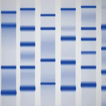 Gel Electrophoresis | The Scientist