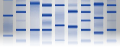 SDS-PAGE Technology for the 21st Century | The Scientist SDS-PAGE Technology for the 21st Century | The Scientist