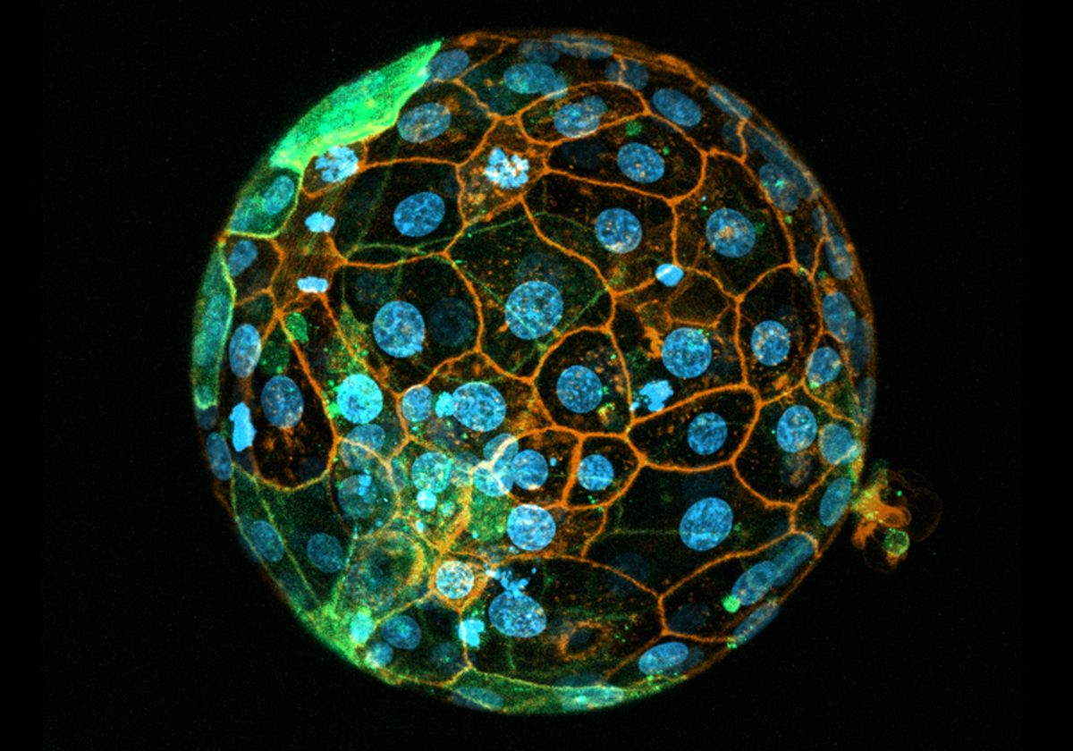 Unraveling the Complex Mysteries of Embryonic Beginnings | The