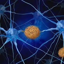 Neurodegenerative Disease Markers and Detection Methods | The ...