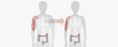 The Neural Circuitry Driving Cancer-Related Wasting Disease | The