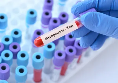 Scientist holding a blood sample tube labeled Mycoplasma test in front of many other tubes containing patient samples