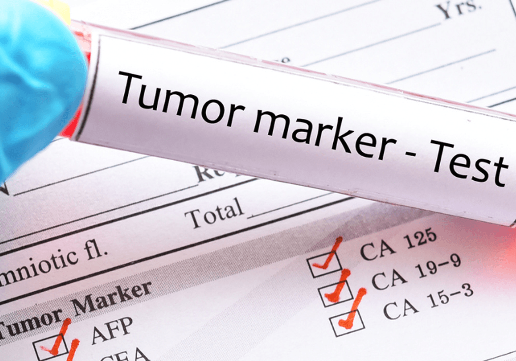 A blue-gloved hand holds a red vial that will be tested for tumor markers. In the background is a lab order form with specific tumor marker tests checked off.
