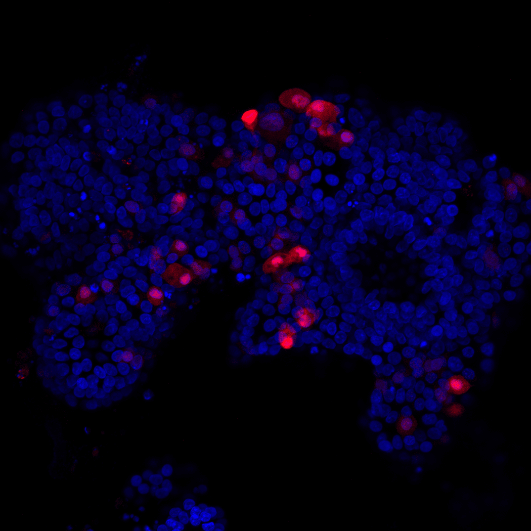 Image of human fetal pancreatic organoids with endocrine cells. The nuclei are stained in blue and endocrine cells in red. Image of human fetal pancreatic organoids with endocrine cells. The nuclei are stained in blue and endocrine cells in red.
