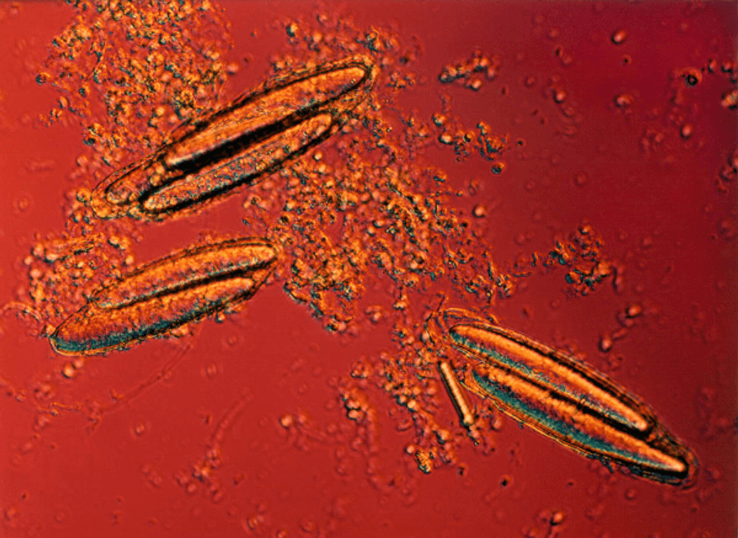 Three dividing bacterium cells seen under a microscope. Three dividing bacterium cells seen under a microscope.