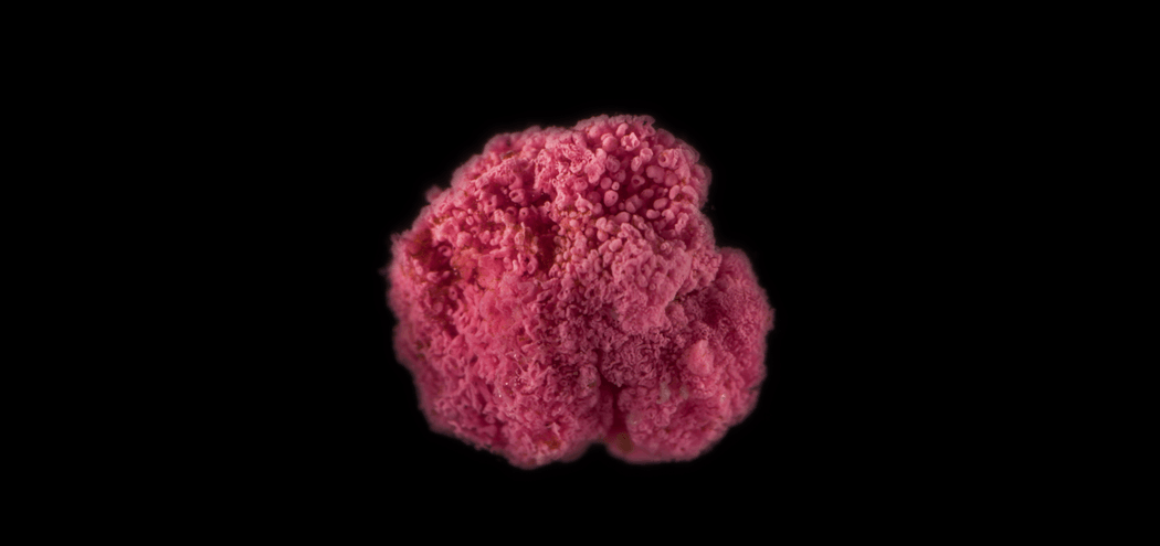 A microscopy image of a pink berry bacterial aggregate. A microscopy image of a pink berry bacterial aggregate.