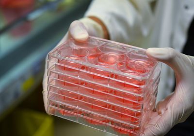A photo of a scientist holding a stack of 6-well plates filled with culture medium.