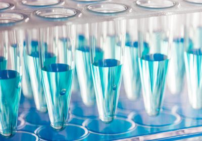 Discover the history, mechanics, and potential of PCR.