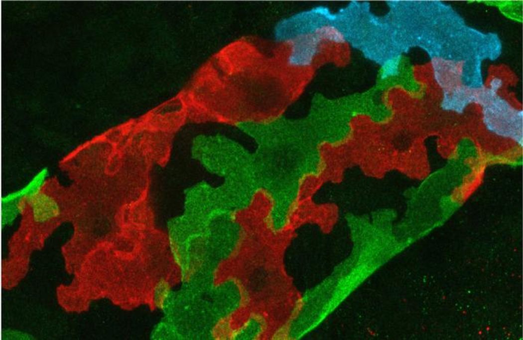 Image of lobate-shaped endothelial cells that are stained in red, green, and blue. Image of lobate-shaped endothelial cells that are stained in red, green, and blue.