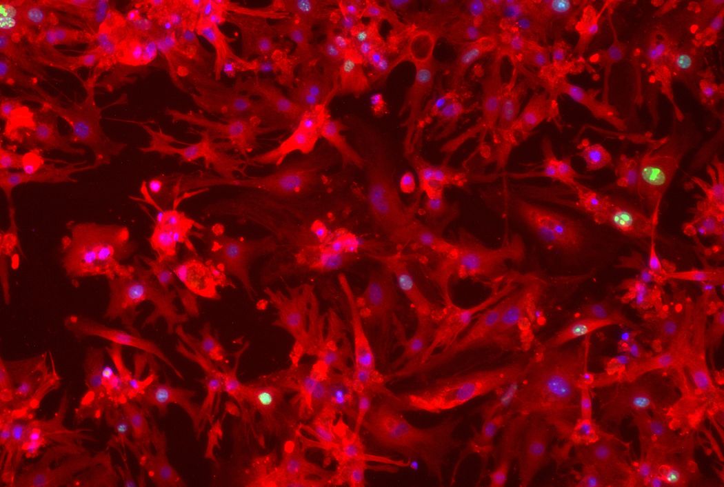 Red-colored cells with some blue and some green nuclei. Red-colored cells with some blue and some green nuclei.