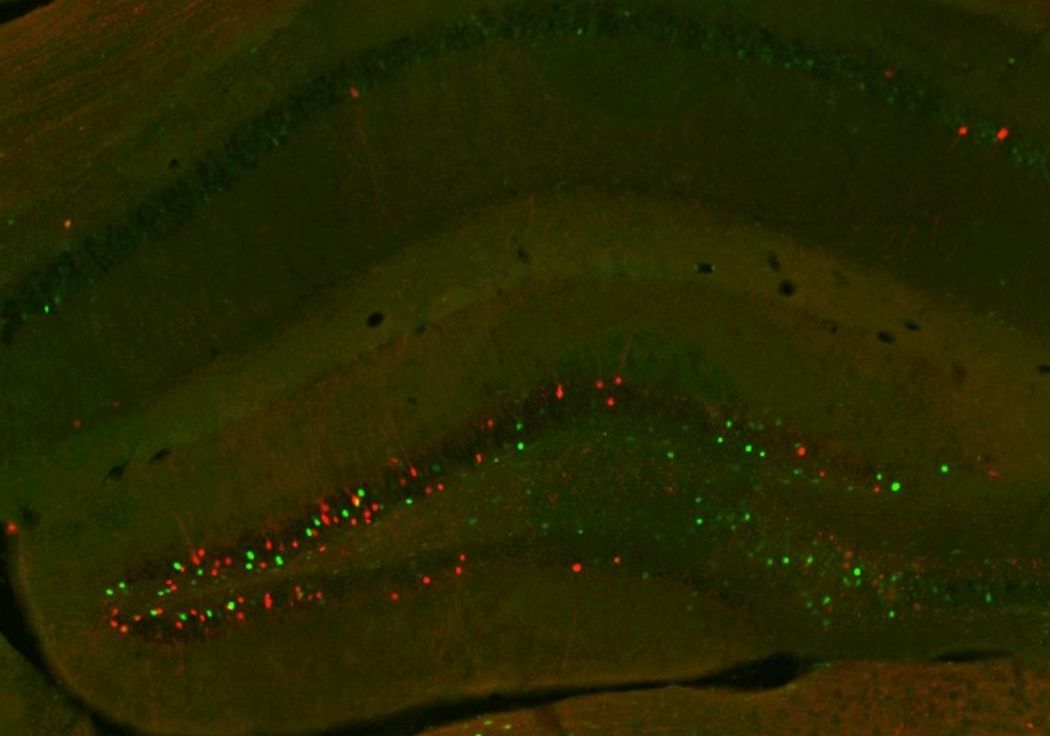 Image of neurons in the hippocampus that responded to an infusion of fat (green) or sugar (red). Image of neurons in the hippocampus that responded to an infusion of fat (green) or sugar (red).