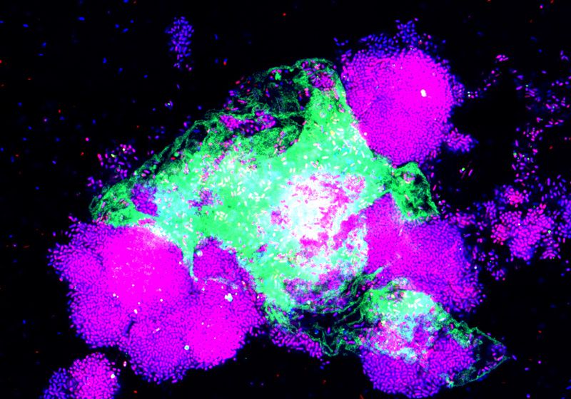 When a Urinary Tract Infection Strikes, What Protects the Kidneys?