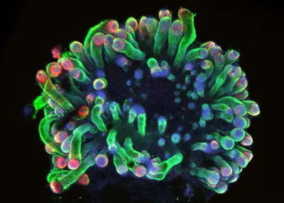 Microscopy image of a 120-day old human skin organoid derived from pluripotent stem cells with tentacle-like hair follicles. The green Keratin 5 stain labels the outer layer of the follicles and the epidermis, while the red PMEL stain marks the melanocytes. Microscopy image of a 120-day old human skin organoid derived from pluripotent stem cells with tentacle-like hair follicles. The green Keratin 5 stain labels the outer layer of the follicles and the epidermis, while the red PMEL stain marks the melanocytes.